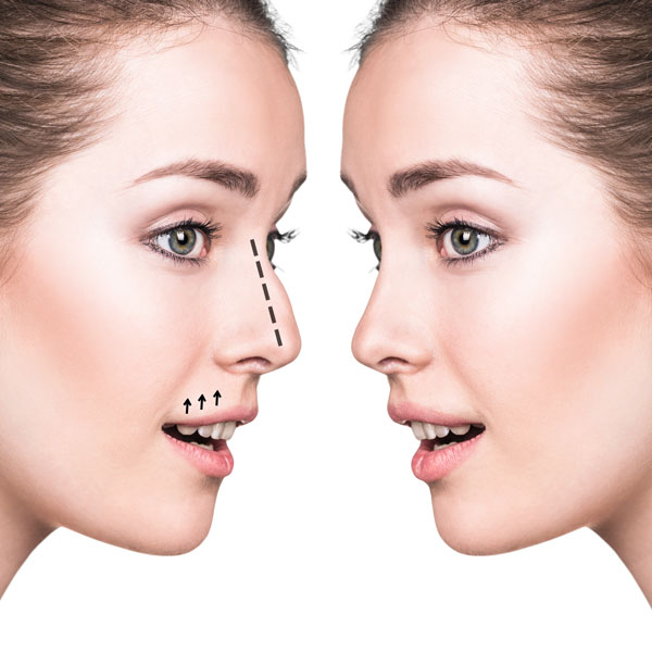 Cosmetic Procedures