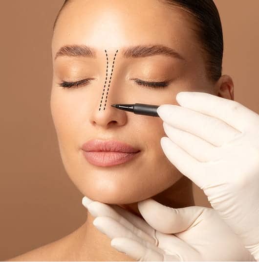 Rhinoplasty