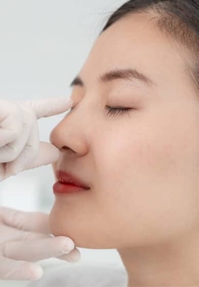 Rhinophyma