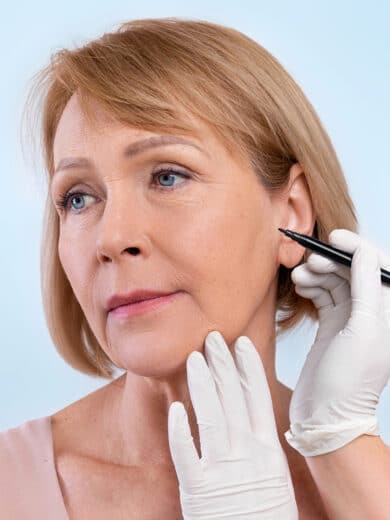 Facelift Benefits