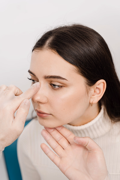 Rhinoplasty  (Nose Job)  in Chicago, IL
